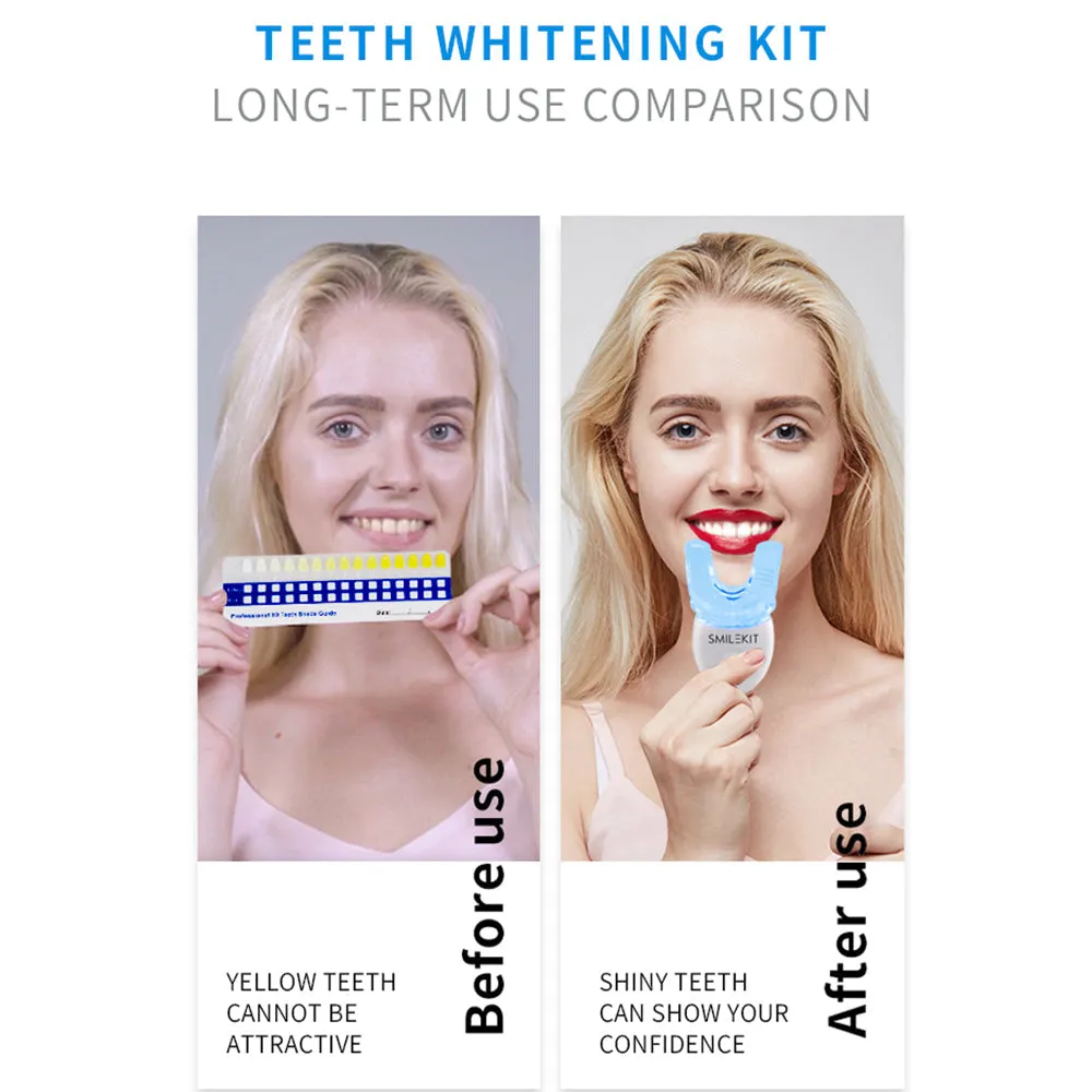 Teeth Whitening Kit with LED Light Professional Cleaning Machine- Battery Operated